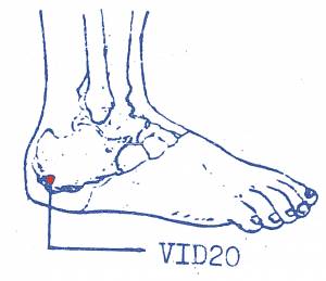 vi-d20.jpg